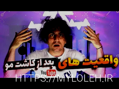 کاشت مو تهران